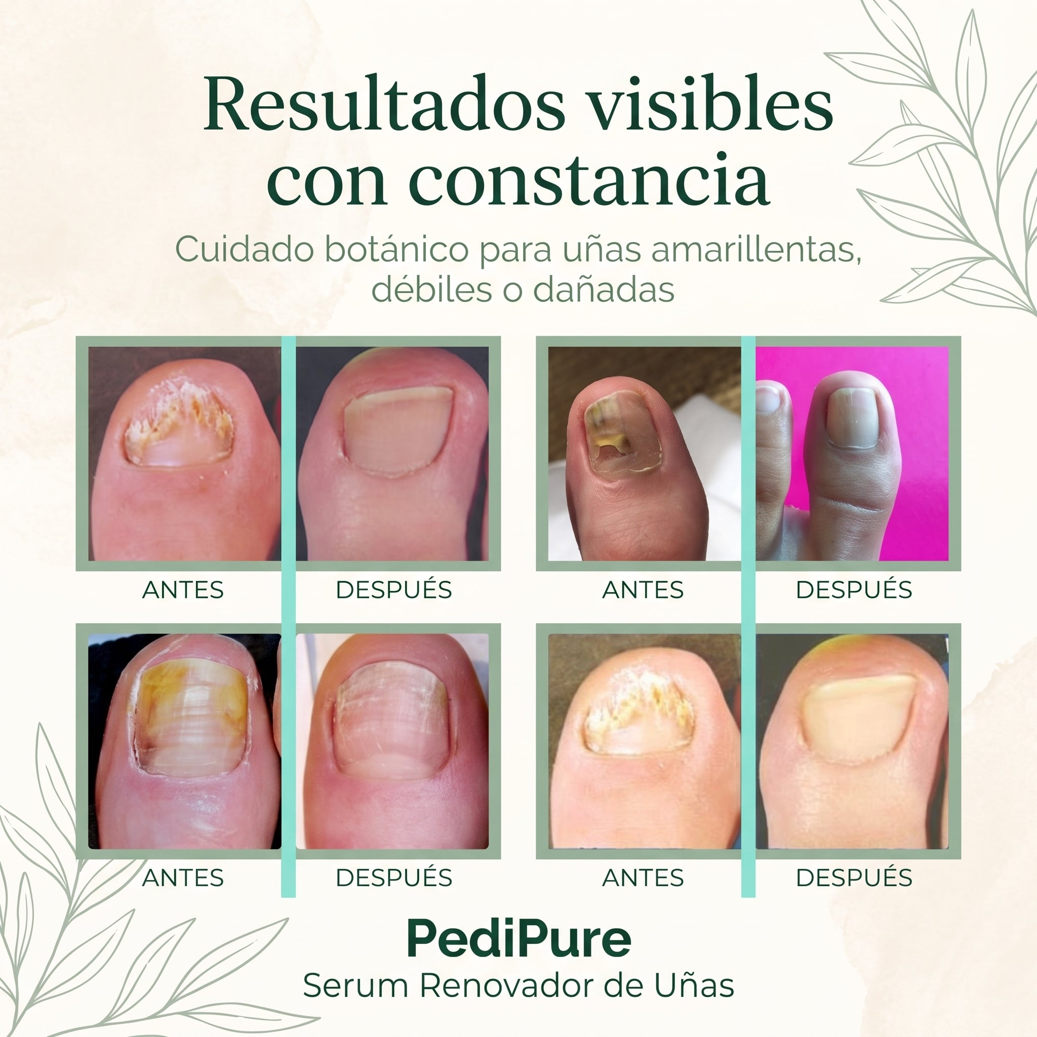 PediPure Serum Renovador de Uñas